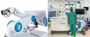 Robotic Knee Raplacement